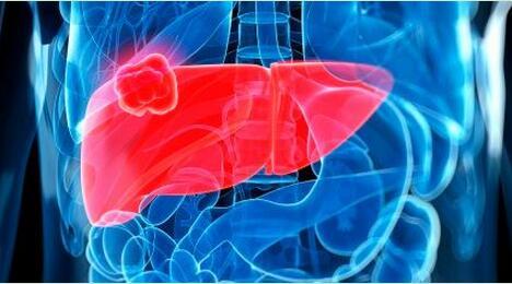 為什么養(yǎng)肝需要補(bǔ)硒？生活中如何保肝護(hù)肝？