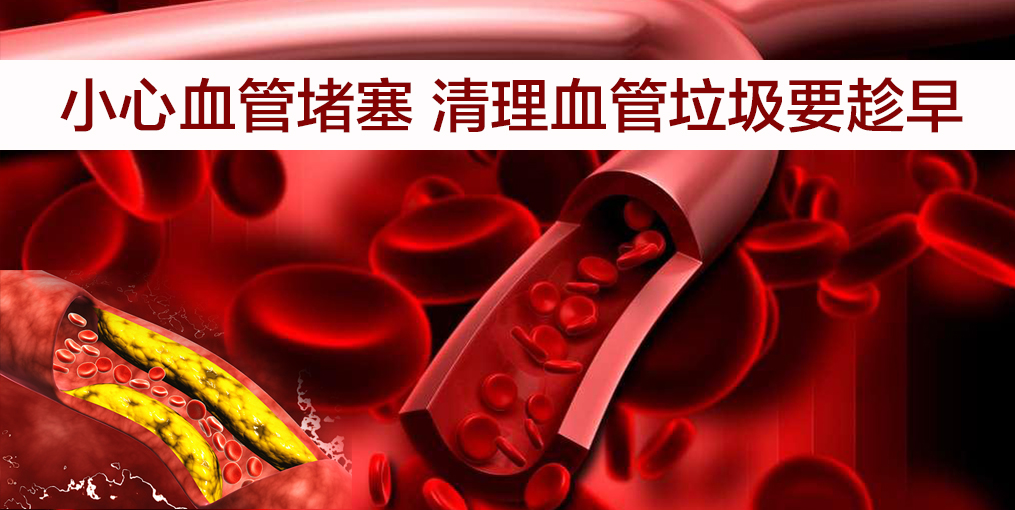 當(dāng)心！這幾類人群血管最易堵，適當(dāng)補(bǔ)硒遠(yuǎn)離血管疾病