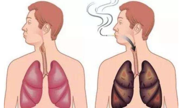 補(bǔ)硒，給你的肺部洗洗澡吧