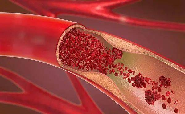 長(zhǎng)期服用他汀類患者為什么要補(bǔ)充輔酶Q10？